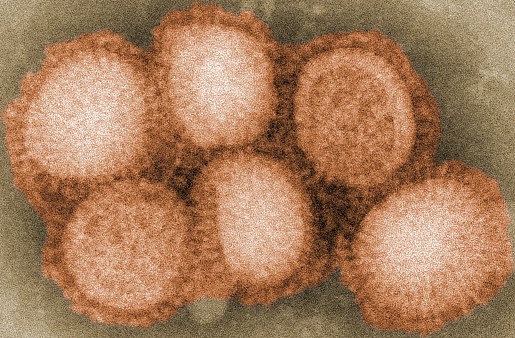 H1N1_navbox